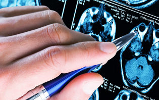 What is Epilepsy?