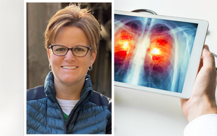 Lung Cancer Screening & Navigation Program